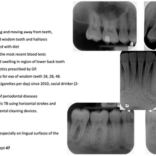 1 Case of Periodontal Disease 