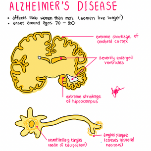 Neurodegenerative Diseases