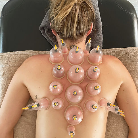 cupping pic.jpeg