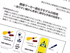 進行膵臓がんの予後指標モデルを開発　名古屋大学などの研究グループ