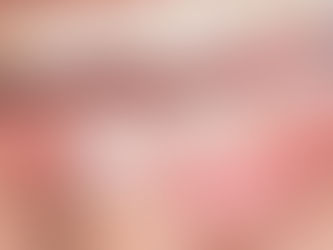 E quando o dente quebra?