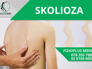 SKOLIOZA