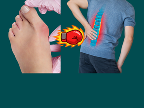 Hallux Valgus May Be Linked to Degenerative Spinal Diseases: What the Latest Cohort Study Suggests