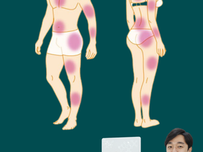 The Role of Physiotherapy in Fibromyalgia: Current Evidence and Future Perspectives