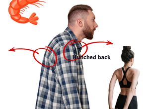 Rounded Shoulders: Causes, Risks, and Two Effective Stretches for Better Posture