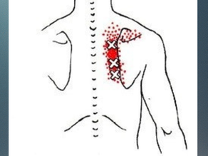 shoulder blade pain