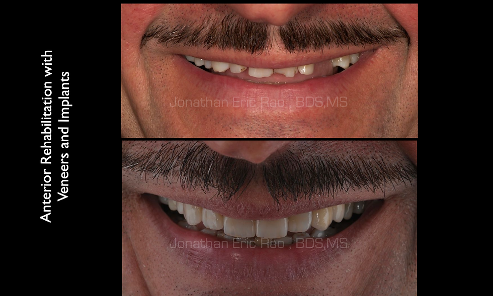 The Curious Case of the Crooked Teeth