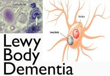 lewy body photo.jpg