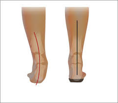 Thumbnail: Helix Star Slipper