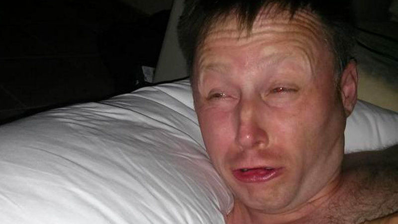 Close-up of a sleepy, squinting man lying on a white pillow in a dim room, looking groggy and disheveled. Freelancer presenting a project proposal that promises enterprise-level results despite limited implementation experience and unclear technical planning