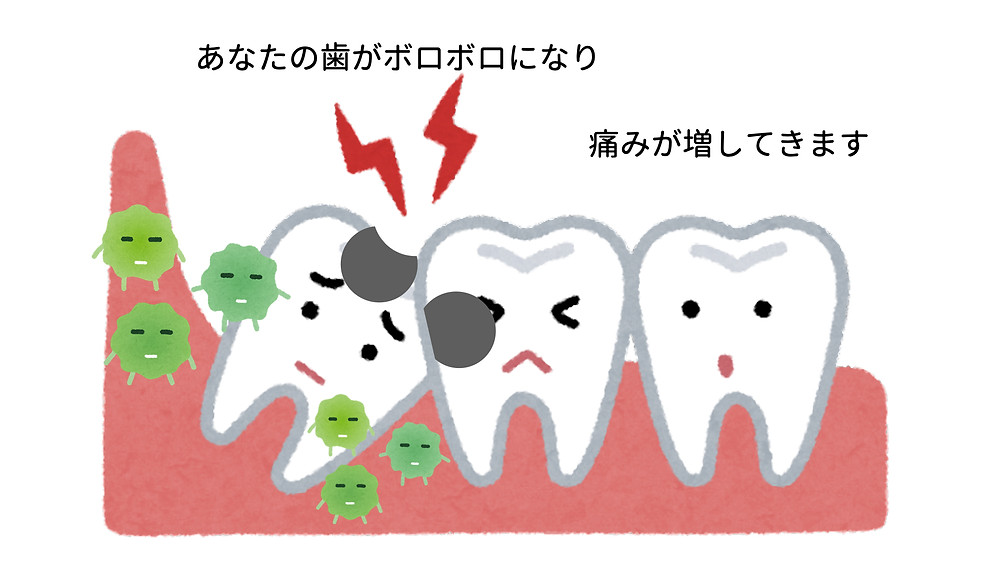 親知らずの周りで発生する問題
