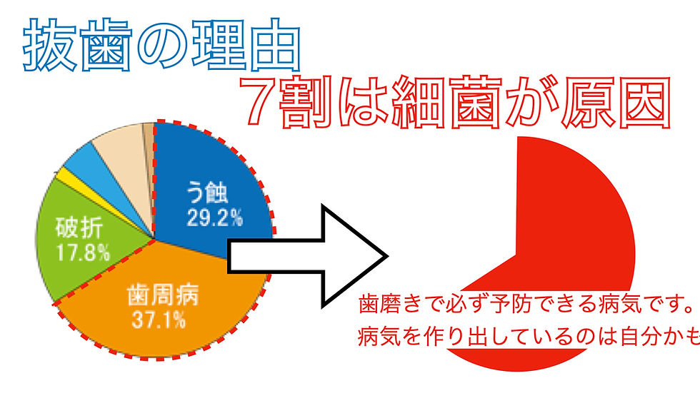 抜歯の原因