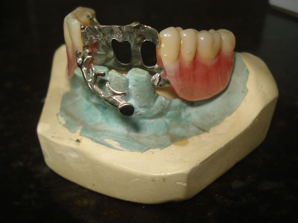 PPR fig1