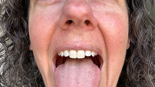 Show me your Tongue!