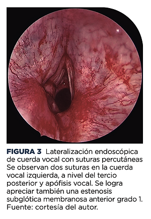 Captura de Pantalla 2022-07-26 a la(s) 13.03.18.png