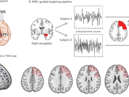 “Estimulação cerebral pode melhorar sintomas de PTSD ao reduzir a atividade do ‘centro do medo’”