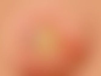 Cannabidiol no combate ao câncer de mama 