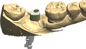 implant02.png