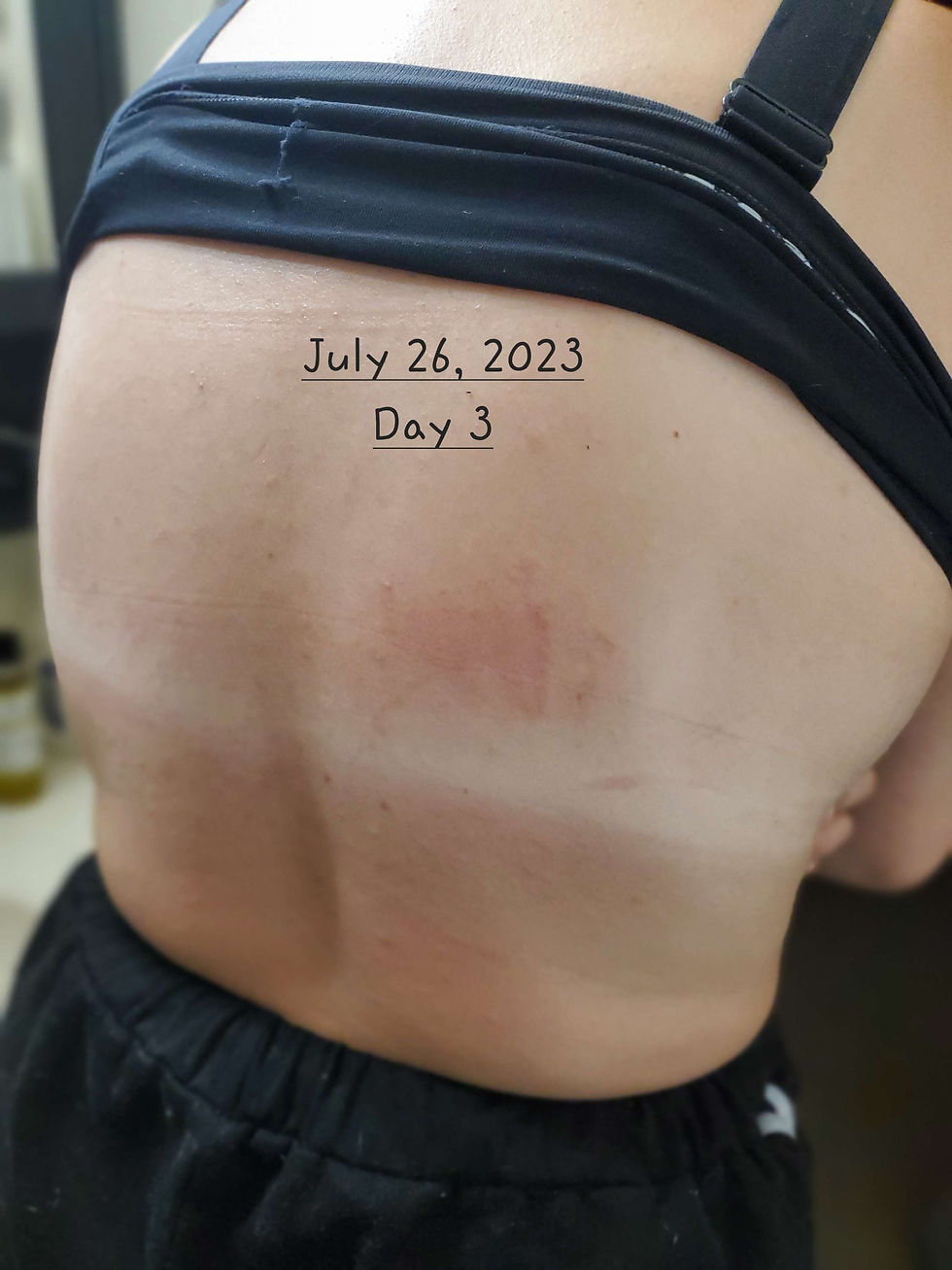 Thumbnail: Sun Burn Remedy Oil 4 oz