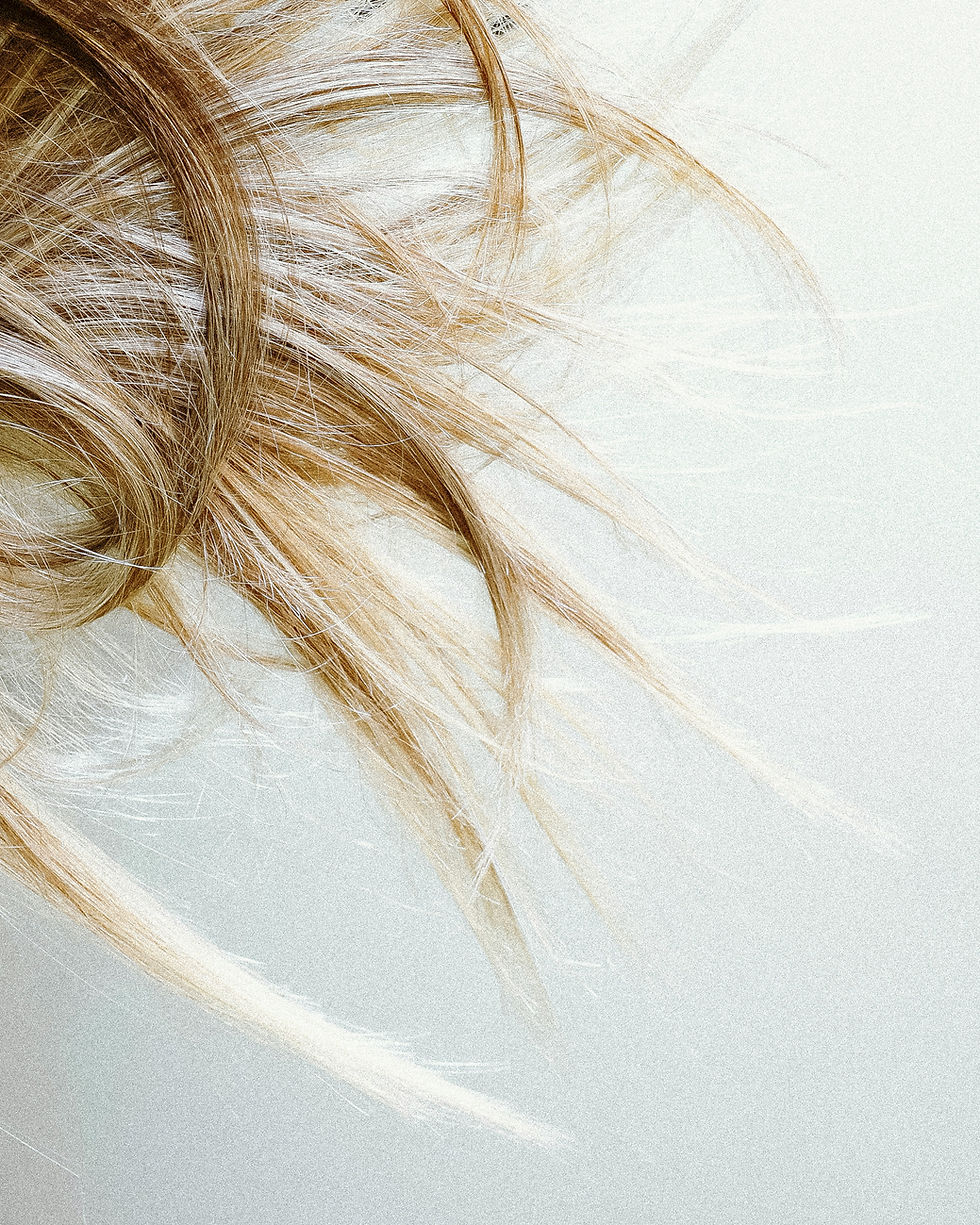 GLP-1 Medications and Hair Loss: What We're Seeing (and Why We're Talking About It)
