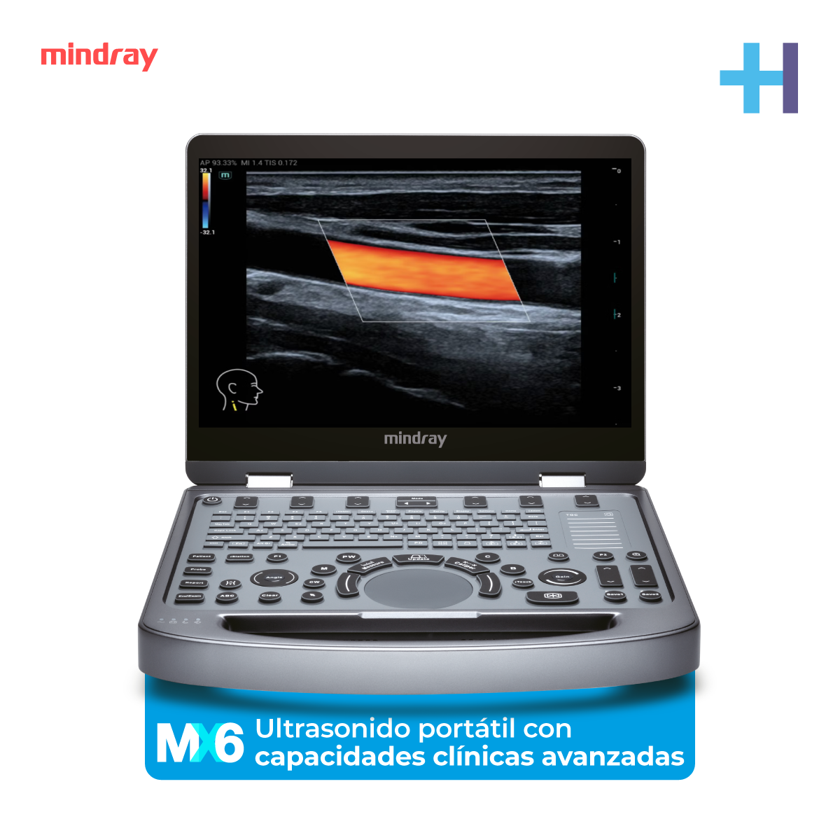Ultrasonido Portátil MX6 con Tecnología ZST+, con Transductor Convexo y Lineal