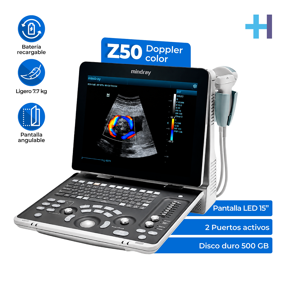 Ultrasonido portátil de ecografía para uso humano Z50, pago por (Z5HBCL)