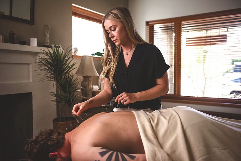 acupuncturist treats a patient