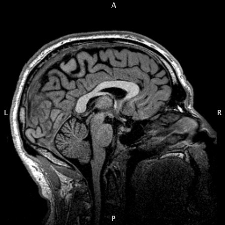 'Inside my head: MRI sagittal' (2018)