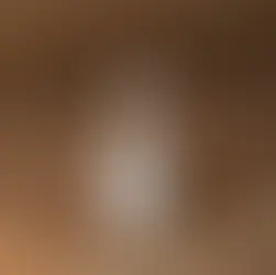 Nosso Sérum Queridinho!