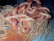 intestinal colic in adults treatment