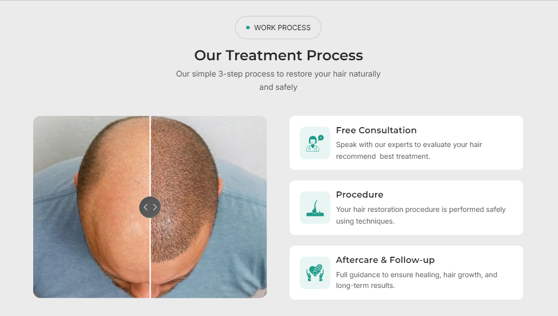 Hair Folixa Our Process overview — complete hair transplant treatment steps and consultation flow for Wix templates