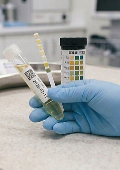 Urine.png