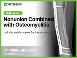 Nonunion Combined with Osteomyelitis