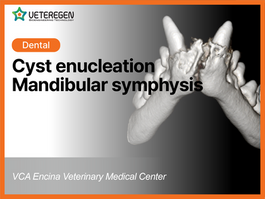 Cyst enucleation, Mandibular symphysis