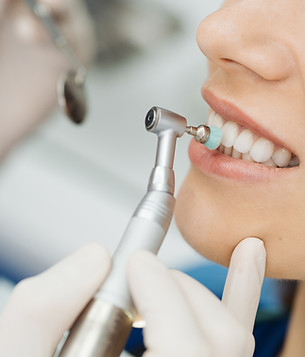 Teeth Cleaning