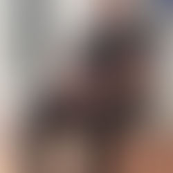 La importancia de la rehabilitación