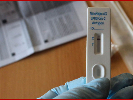 Se eleva a 37 cifra de estudiantes contagiados; sólo han acudido 50