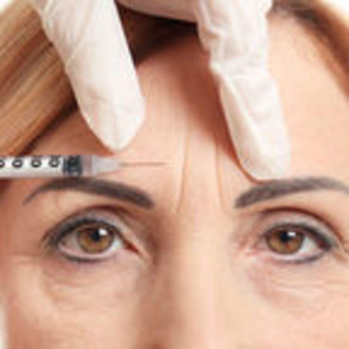 Neuromodulator Injections
