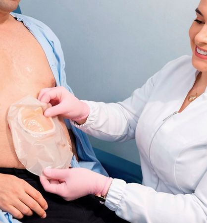 bolsa-de-colostomia,-ileostomia-e-urostomia.jpg
