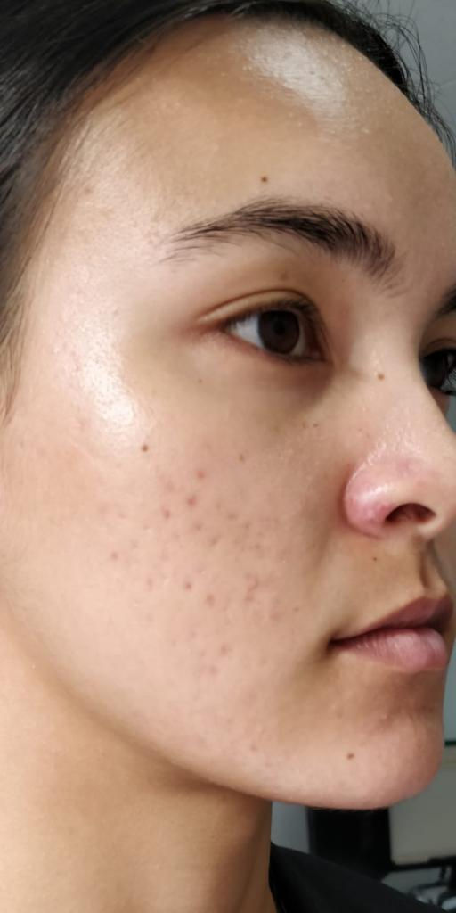 縮圖：PepFactor Skin — 12 Treatment Kits (Clinic 12-Pack)