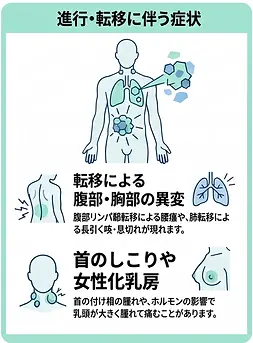 精巣がんの進行症状のイラスト
