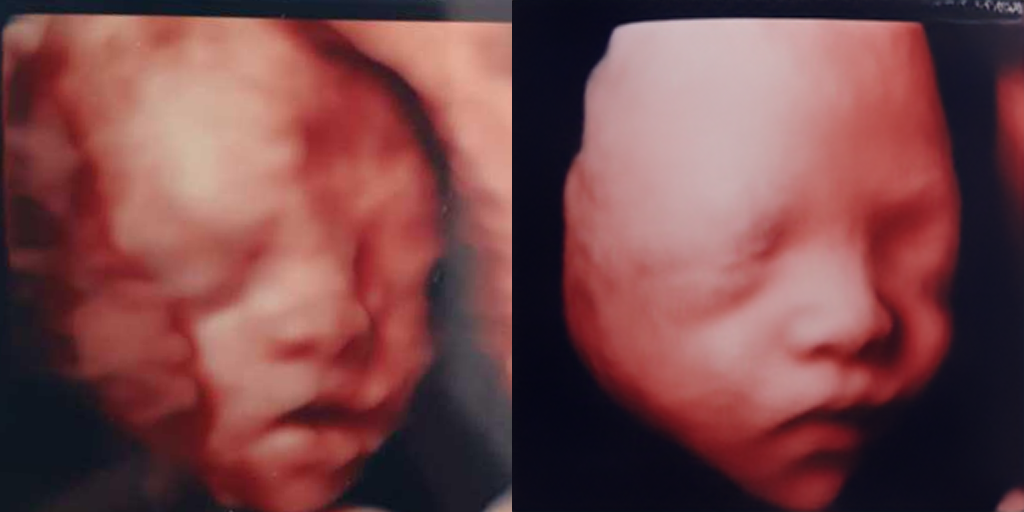 노이즈 제거 복원 예시 1