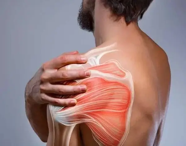 shoulder-pain 26.webp