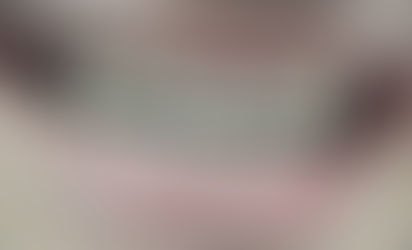 Reabilitare estetică și funcțională