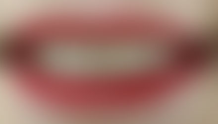 Schimbăm zâmbete, redăm încrederea de sine!