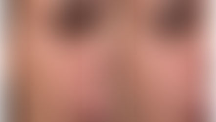 Why Choose XERF at Renaissance MD?