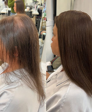 Topper hair replacement for thinning hair