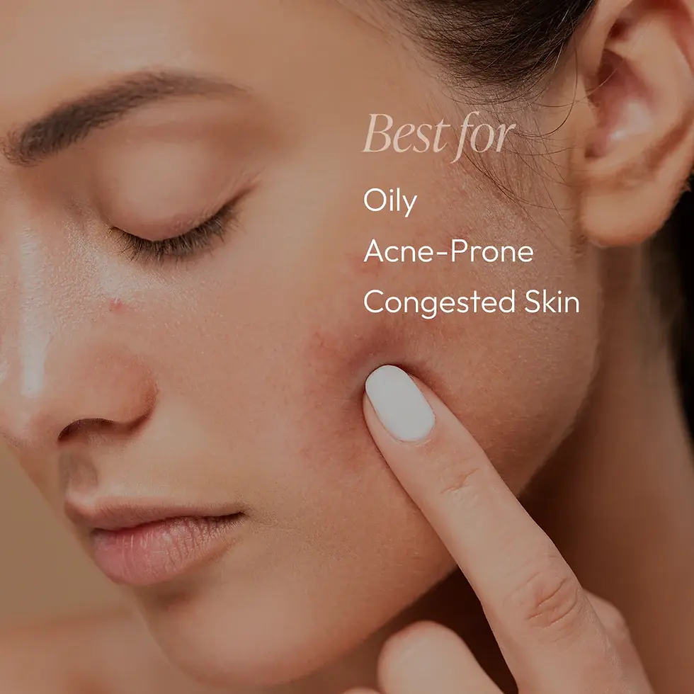 Thumbnail: Acne Essentials Regimen Kit