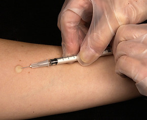 Injection