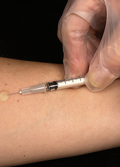 Injection in arm